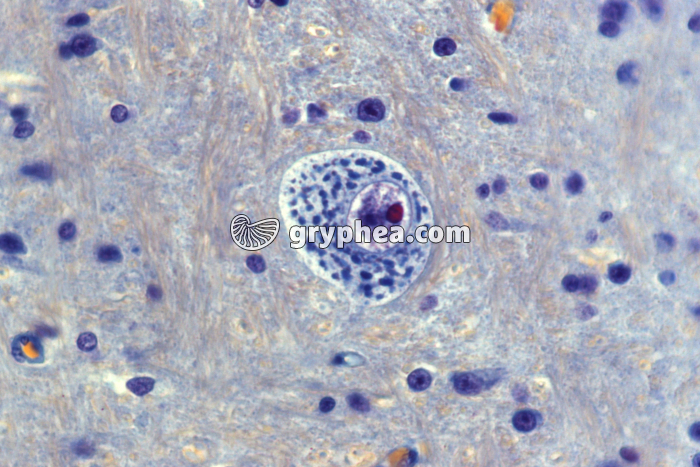 Neurône Nissl x160 - gryphea.com